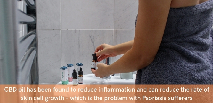Can you use CBD oil for psoriasis
