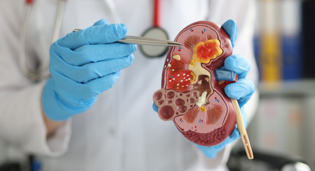 Looking at kidney to determine if Is CBD oil harmful to the kidneys