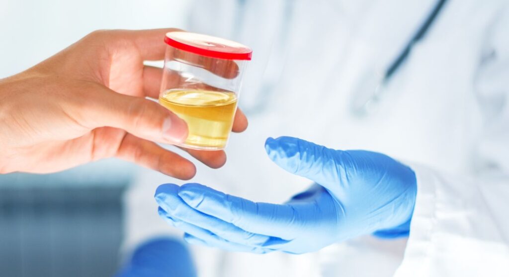 Giving urine to doctor for a CBD drug test